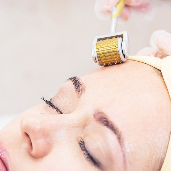 Lăn kim PRP (Microneedling)