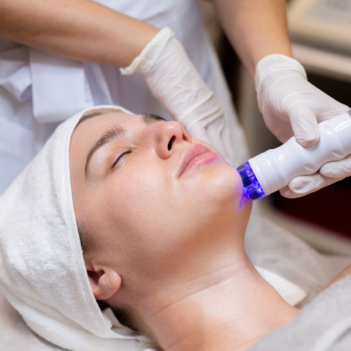 Laser CO2 Fractional kết hợp PRP