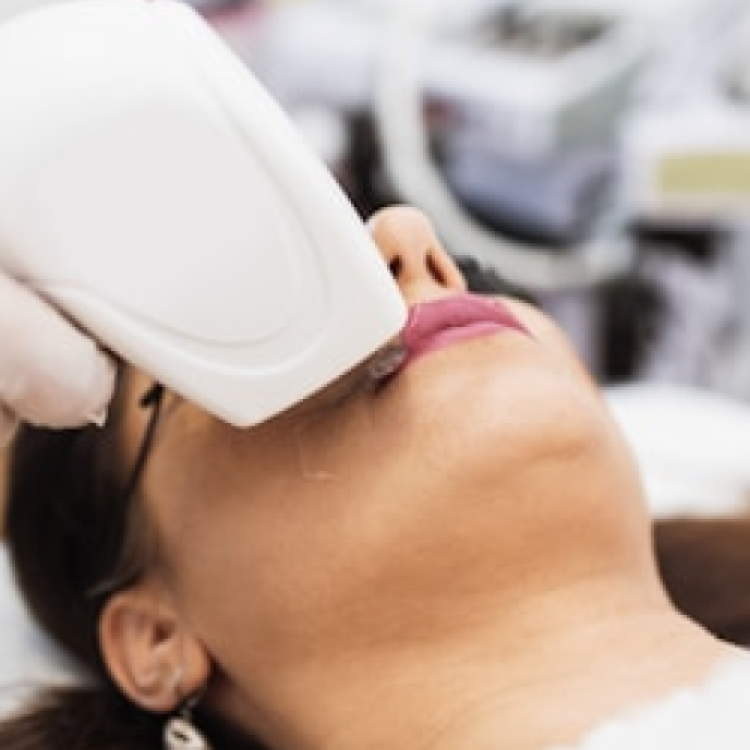 Laser carbon/Laser trẻ hóa da, se khít lỗ chân lông